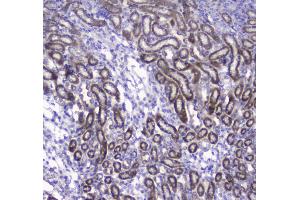 IHC analysis of COX IV using anti-COX IV antibody .