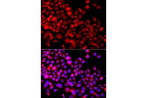 Immunofluorescence analysis of A549 cells using CALCOCO1 antibody (ABIN5975736). (CALCOCO1 anticorps)