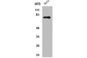 Western Blot analysis of HELA cells using Phospho-Btk (Y551) Polyclonal Antibody (BTK anticorps  (pTyr551))