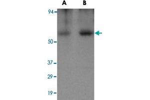Western blot analysis of CLU in human brain tissue lysate with CLU polyclonal antibody  at (A) 0. (Clusterin anticorps)