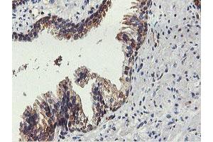 Image no. 3 for anti-Farnesyl-Diphosphate Farnesyltransferase 1 (FDFT1) antibody (ABIN1498243)