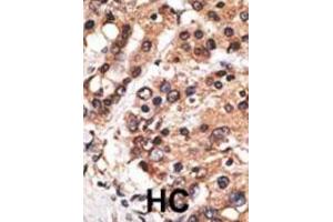 Immunohistochemistry (IHC) image for anti-Protein AF-9 (MLLT3) antibody (ABIN2971008) (AF9 anticorps)
