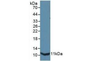 Detection of Recombinant IL13Ra2, Mouse using Polyclonal Antibody to Interleukin 13 Receptor Alpha 2 (IL13Ra2) (IL13RA2 anticorps  (AA 228-338))
