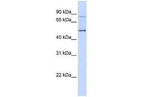 WB Suggested Anti-ALS2CR12 Antibody Titration: 0. (ALS2CR12 anticorps  (N-Term))