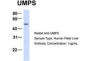 Host:  Rabbit  Target Name:  UMPS  Sample Type:  Human Fetal Liver  Antibody Dilution:  1. (UMPS anticorps  (C-Term))