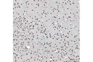 IHC analysis of RTCB using anti-RTCB antibody (ABIN7600722). (C22orf28 anticorps  (AA 227-505))