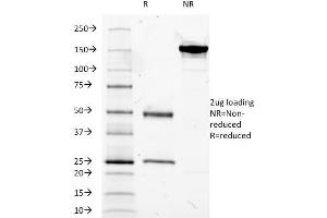 SDS-PAGE Analysis Purified CD14-Monospecific Mouse Monoclonal Antibody (LPSR/2385). (CD14 anticorps  (AA 25-148))
