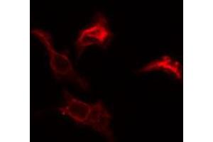 ABIN6274782 staining COLO205 cells by IF/ICC. (RPL39 anticorps  (C-Term))