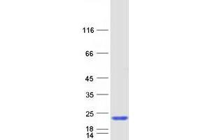 Validation with Western Blot
