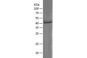 Western Blotting (WB) image for CD177 Molecule (CD177) (AA 22-408) protein (His-IF2DI Tag) (ABIN7122193)