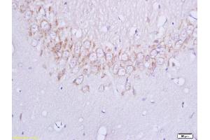 Formalin-fixed and paraffin embedded rat brain labeled with Anti-Plexin B1 Polyclonal Antibody, Unconjugated (ABIN749228) at 1:200 followed by conjugation to the secondary antibody and DAB staining (PLXNB1 anticorps  (AA 151-250))