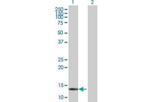 Western Blot analysis of CRABP2 expression in transfected 293T cell line by CRABP2 MaxPab polyclonal antibody. (CRABP2 anticorps  (AA 1-138))