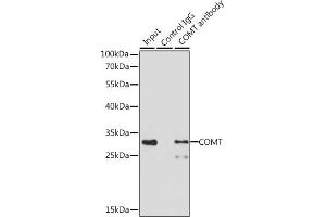 Immunoprecipitation analysis of 200 μg extracts of MCF-7 cells, using 3 μg COMT antibody (ABIN1679321, ABIN3015439, ABIN3015440 and ABIN6216759). (COMT anticorps  (AA 42-221))