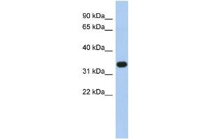 WB Suggested Anti-SULT1B1 Antibody Titration:  0. (SULT1B1 anticorps  (N-Term))