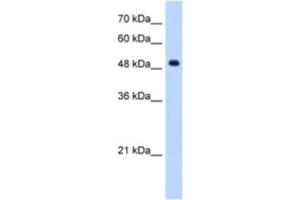 Western Blotting (WB) image for anti-Septin 6 (SEPT6) antibody (ABIN2462958) (Septin 6 anticorps)