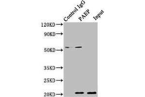 Immunoprecipitating PAEP in 293T whole cell lysate Lane 1: Rabbit control IgG instead of ABIN7154198 in 293T whole cell lysate.