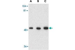 Western blot analysis of GOPC in rat colon cell lysate with GOPC polyclonal antibody  at (A) 1, (B) 2 and (C) 4 ug/mL . (GOPC anticorps  (C-Term))