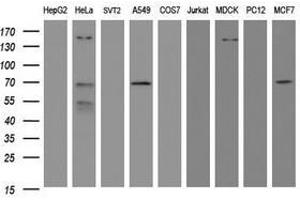 Image no. 4 for anti-Methyltransferase Like 16 (METTL16) antibody (ABIN1499432)
