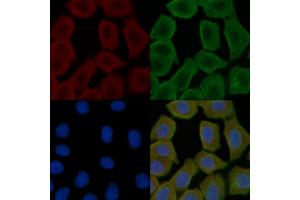 ABIN6258508 and ABIN6274718 staining Hela cells(30 min of UV treatment) by IF/ICC. (MRPS16 anticorps  (Internal Region))