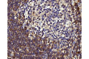 Immunohistochemistry analysis of paraffin-embedded human tonsil using c-Kit Polyclonal Antibody at dilution of 1:200. (KIT anticorps)