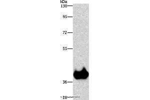 Western blot analysis of Mouse brain tissue, using ASPA Polyclonal Antibody at dilution of 1:1150 (ASPA anticorps)