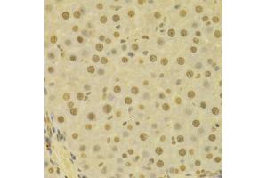 Immunohistochemistry of paraffin-embedded human liver using COPS5 antibody (ABIN5970887) at dilution of 1/100 (40x lens). (COPS5 anticorps)