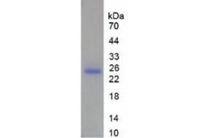 SDS-PAGE of Protein Standard from the Kit  (Highly purified E. (MMP13 Kit ELISA)