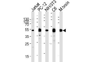 Western blot analysis of lysates from Jurkat,rat PC-12,mouse NIH/3T3,rat C6 cell line and mouse brain tissue (from left to right),using P2K1 Antibody (P1) (ABIN1882101 and ABIN2842058).