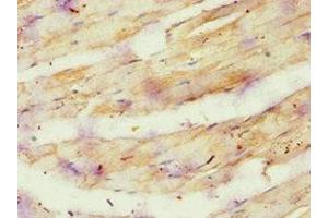Immunohistochemistry of paraffin-embedded human skeletal muscle tissue using ABIN7144869 at dilution of 1:100 (ATP5O anticorps  (AA 24-213))