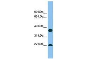 Image no. 1 for anti-WAP Four-Disulfide Core Domain 1 (WFDC1) (C-Term) antibody (ABIN6745156)