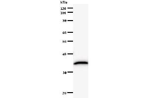 Western Blotting (WB) image for anti-RAR-Related Orphan Receptor C (RORC) antibody (ABIN932197) (RORC anticorps)