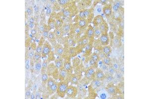 Immunohistochemistry of paraffin-embedded mouse liver using AARS antibody (ABIN7265526) at dilution of 1:100 (40x lens).