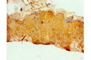 Immunohistochemistry of paraffin-embedded human skin tissue using ABIN7171955 at dilution of 1:100 (ERCC2 anticorps  (AA 1-300))