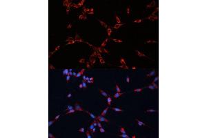 Immunofluorescence analysis of NIH-3T3 cells using GN Polyclonal Antibody (ABIN7267538) at dilution of 1:100 (40x lens).