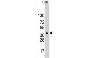 Western Blotting (WB) image for anti-Hepatoma-Derived Growth Factor (HDGF) antibody (ABIN3002632) (HDGF anticorps)
