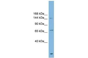 ABCB1 antibody used at 1 ug/ml to detect target protein. (ABCB1 anticorps)