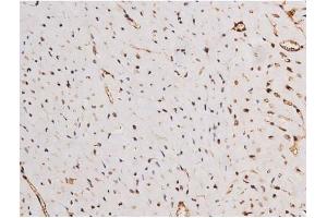 ABIN6267354 at 1/200 staining Mouse heart tissue sections by IHC-P.