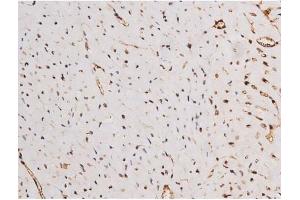 ABIN6267354 at 1/200 staining Mouse heart tissue sections by IHC-P. (MAPT anticorps  (pSer235))