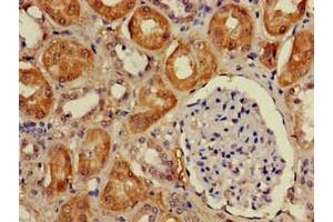 Immunohistochemistry of paraffin-embedded human kidney tissue using ABIN7149804 at dilution of 1:100 (DDA1 anticorps  (AA 1-102))