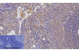 Immunohistochemical analysis of paraffin-embedded rat spleen tissue. (PDGFRA anticorps)