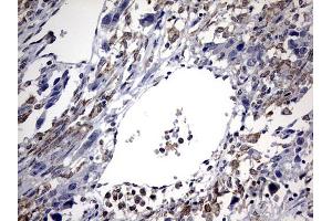 Immunohistochemistry (IHC) image for anti-ATP-Binding Cassette, Sub-Family D (Ald), Member 1 (ABCD1) (AA 508-745) antibody (ABIN2715621) (ABCD1 anticorps  (AA 508-745))