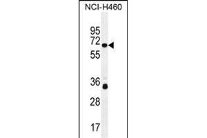 ZN Antibody (N-term) (ABIN655452 and ABIN2844980) western blot analysis in NCI- cell line lysates (35 μg/lane).
