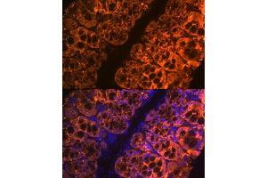 Immunofluorescence analysis of mouse large intestine using Galectin 4/LG Rabbit mAb (ABIN1679347, ABIN3017979, ABIN3017980 and ABIN7101554) at dilution of 1:100 (40x lens). (GAL4 anticorps)
