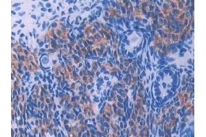 Detection of UMODL1 in Mouse Ovary Tissue using Polyclonal Antibody to Uromodulin Like Protein 1 (UMODL1) (UMODL1 anticorps  (AA 34-306))