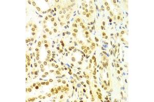 Immunohistochemistry of paraffin-embedded Human kidney using DKC1 antibody at dilution of 1:100 (x400 lens). (DKC1 anticorps  (AA 245-514))