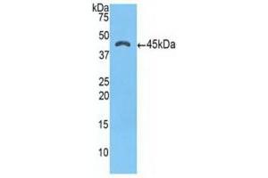 Western blot analysis of recombinant Human a1ACT. (SERPINA3 anticorps  (AA 235-394))