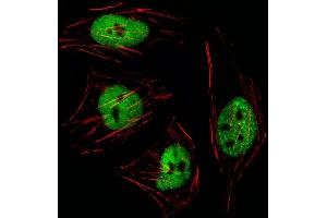 Fluorescent image of Hela cell stained with GTF2I Antibody (N-term) (ABIN1539271 and ABIN2849619)/SA111012BI.