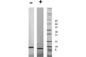 SDS-PAGE of Human Connective Tissue Growth Factor Recombinant Protein SDS-PAGE of Human Connective Tissue Growth Factor Recombinant Protein. (CTGF Protéine)