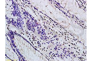 Formalin-fixed and paraffin embedded mouse stomach labeled with Anti-TBL1X Polyclonal Antibody, Unconjugated (ABIN705416) at 1:200 followed by conjugation to the secondary antibody and DAB staining (TBL1Y anticorps  (AA 501-577))