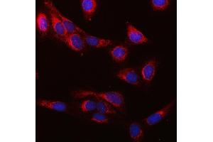IF analysis of SUCLG1 using anti-SUCLG1 antibody (ABIN7600906). (SUCLG1 anticorps  (AA 25-346))